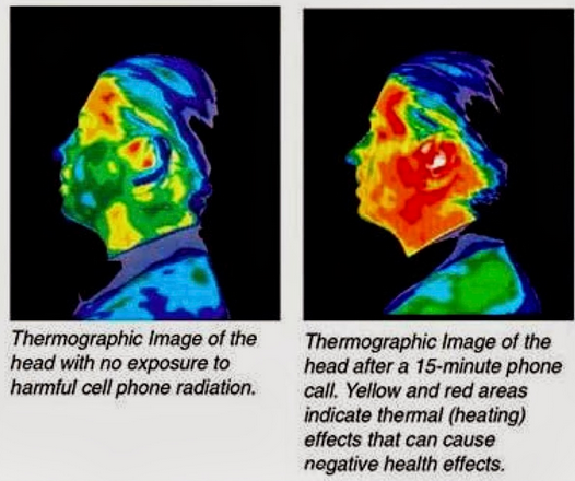Thermogram before and after cell phone use